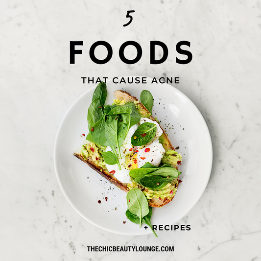 5 Foods That Cause Acne